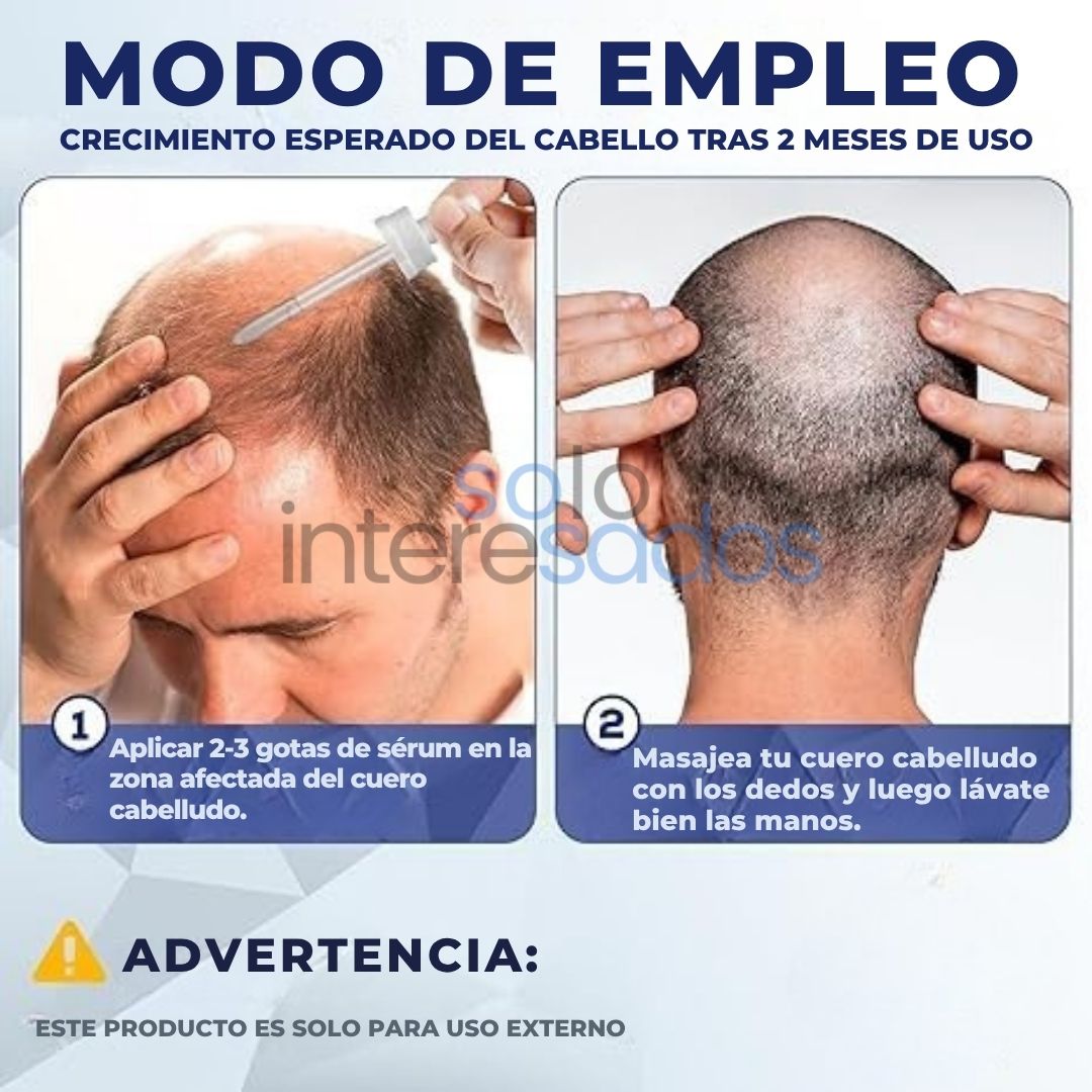 Minoxidil – Crecimiento Capilar y Regeneración Natural ORIGINAL 50ML (HOMBRES Y MUJERES)