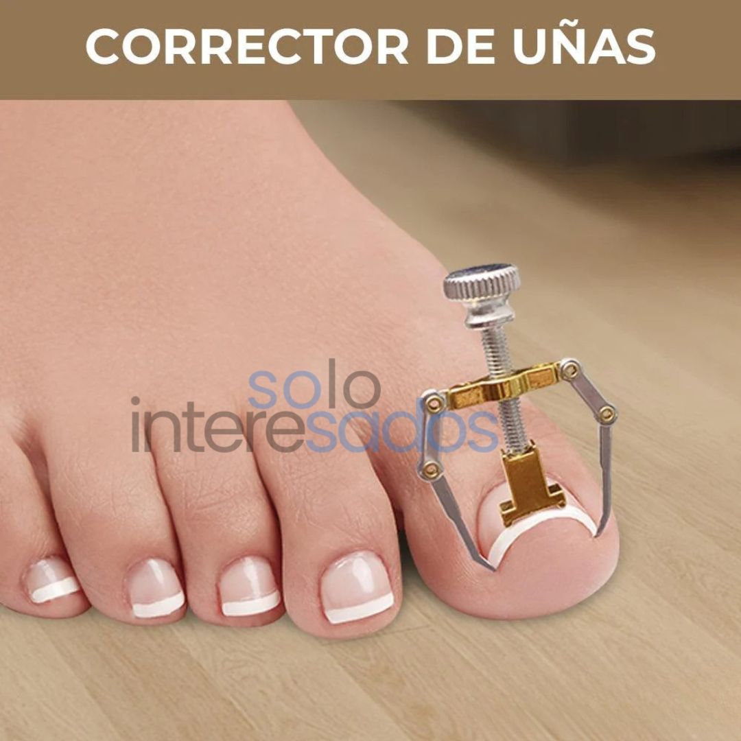 Corrector Pro de Uñas Encarnadas – Repara y Libera al Instante + ESTUCHE METÁLICO