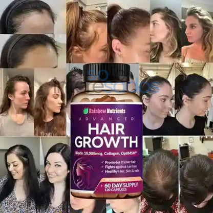 Biotina Hair Growth – Fortalece tu cabello y devolvéle su brillo natural (120 cápsulas)