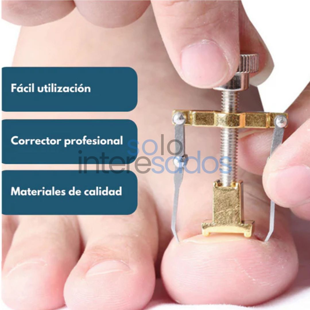 Corrector Pro de Uñas Encarnadas – Repara y Libera al Instante + ESTUCHE METÁLICO