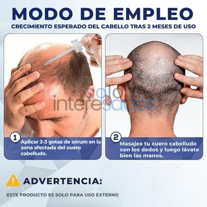 Minoxidil – Crecimiento Capilar y Regeneración Natural ORIGINAL 50ML (HOMBRES Y MUJERES)