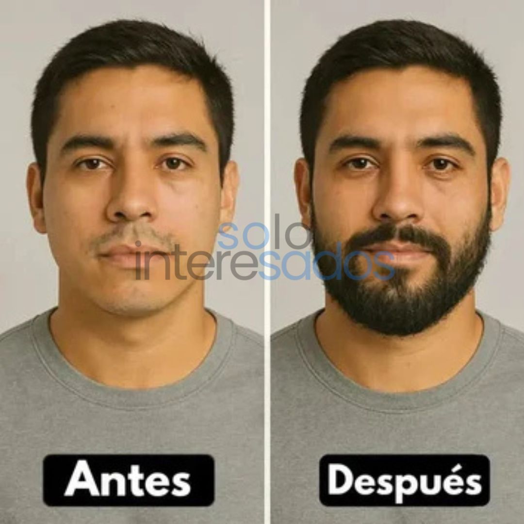 Minoxidil – Crecimiento Capilar y Regeneración Natural ORIGINAL 50ML (HOMBRES Y MUJERES)